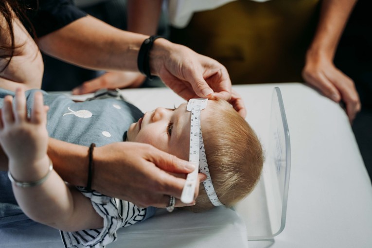 An infant is having its head circumference measured as part of a routine health check. SAHMRI medical research