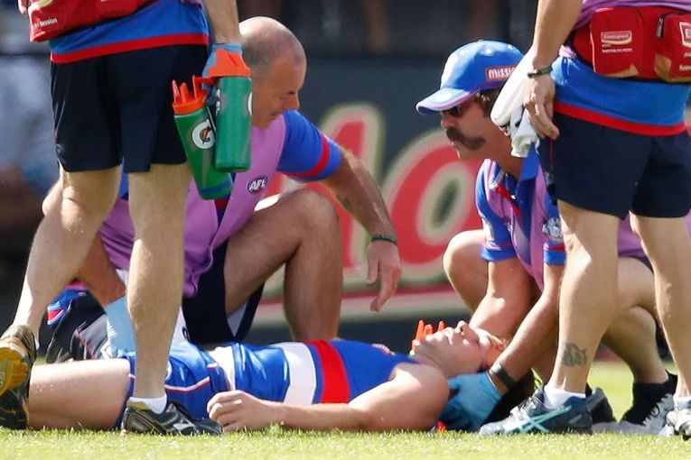 Thumbnail for A year since governments vowed to do better at treating concussion, the silence is deafening