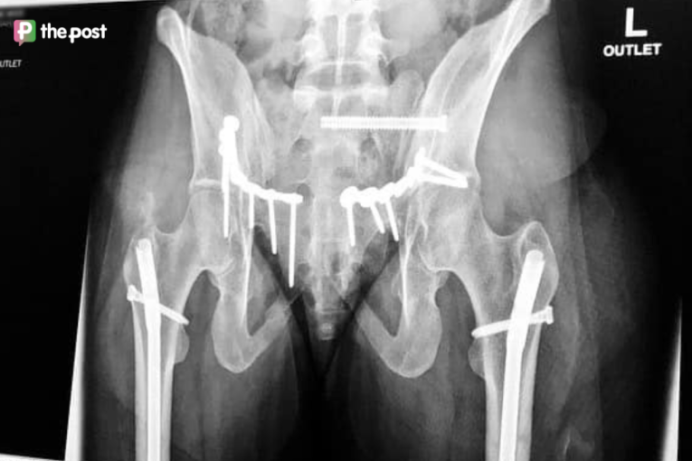 Thumbnail for My body was broken’: Holly’s powerful plea these holidays
