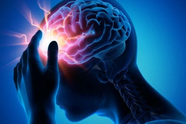Thumbnail for Migraine drug offers fresh hope to millions