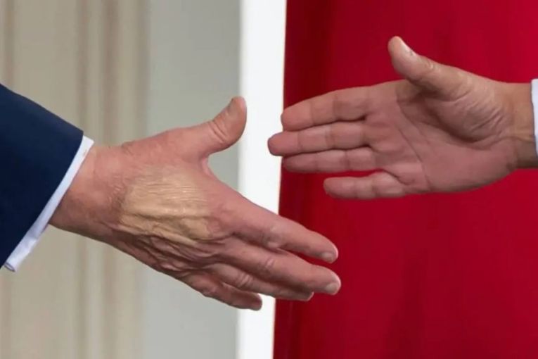 Thumbnail for Trump’s swollen legs, bruised hand – the doctor’s verdict