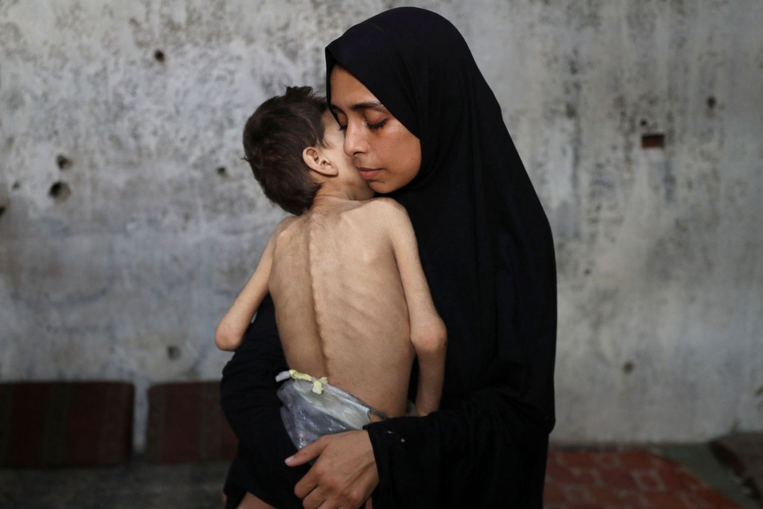 Samah Matar with her son Yousef, 6, who suffers from malnutrition and cerebral palsy, photographed on July 26. Picture: Jehad Alshrafi/AP