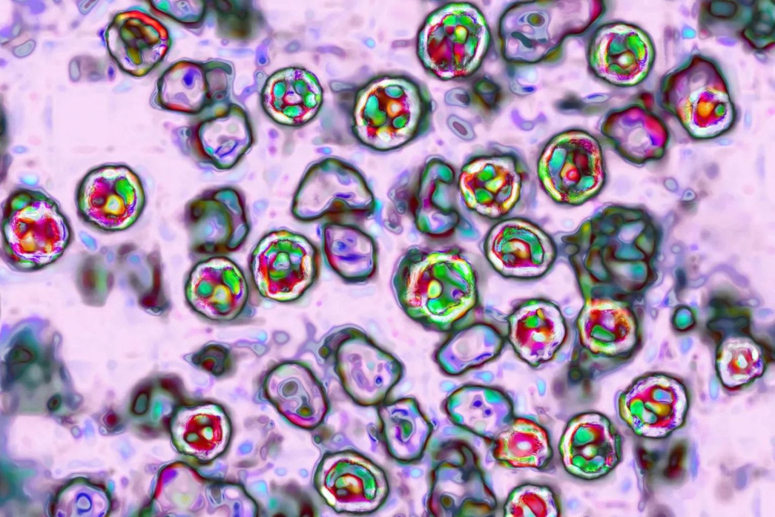 Epidemiologists warn of the risk of measles spreading through travel from Queensland to the MCG