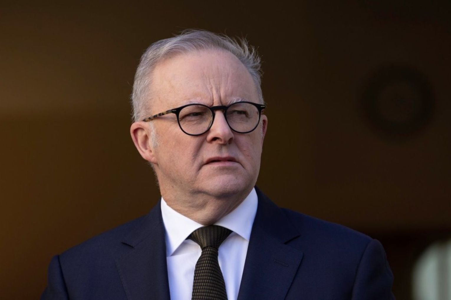 The opposition says Anthony Albanese could make changes to entitlements "with a stroke of the pen". Photo: AAP