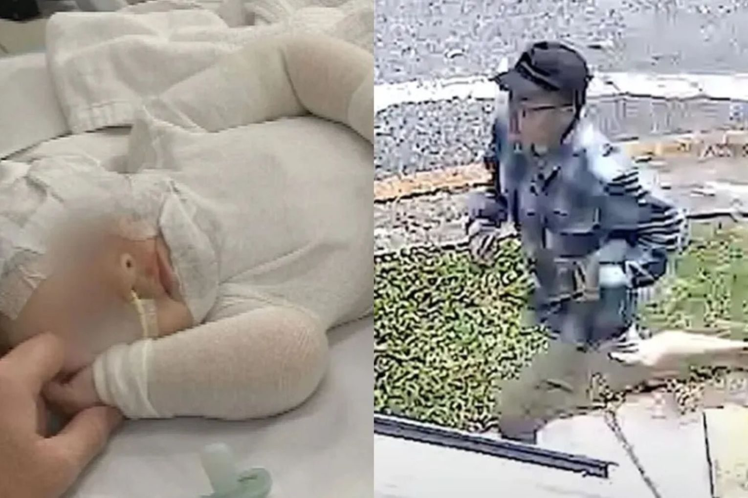 Baby Luka suffered horrific burns to his chest, neck and face and endured eight surgeries. 