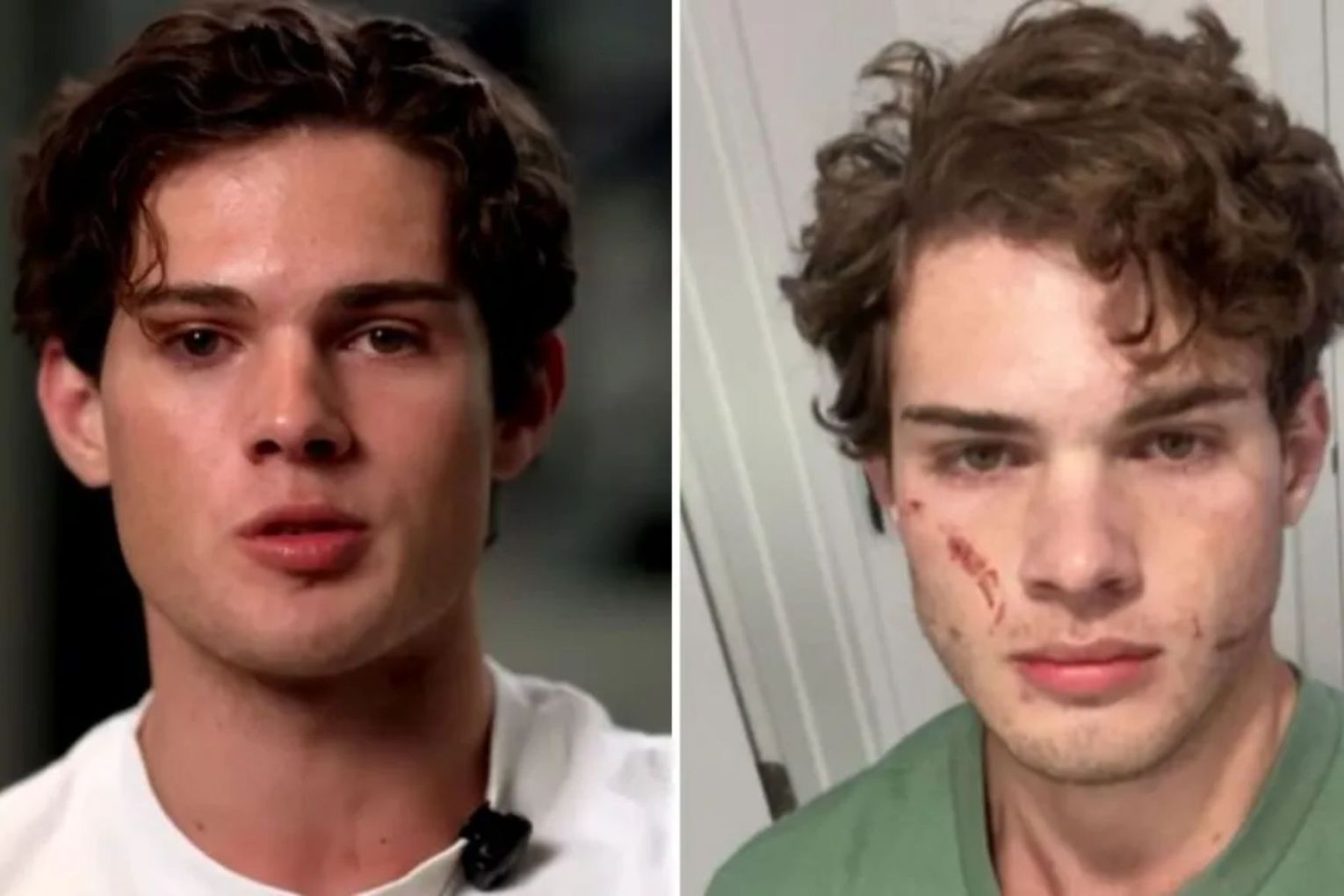 Thumbnail for Inside the bizarre and disturbing trend of ‘looksmaxxing’