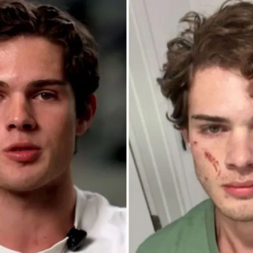 Thumbnail for Inside the bizarre and disturbing trend of ‘looksmaxxing’