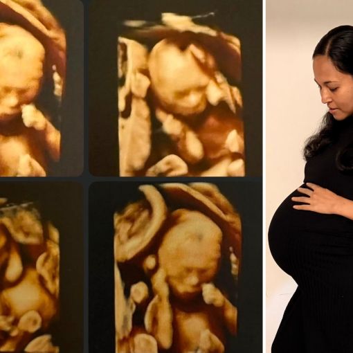 Thumbnail for Parents of rare quadruplets double their brood – and sextuple fundraising target