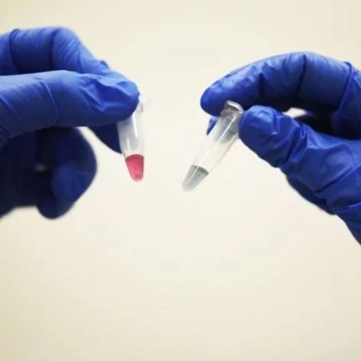 Thumbnail for Skin cancer breakthrough could cut death risk by almost half